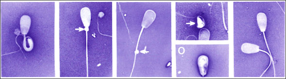 normal sperm motility