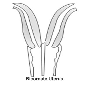 Chromosome abnormality