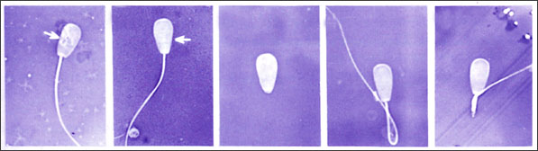 sperm motility test