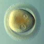 egg donation